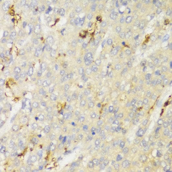 Polyclonal Rabbit anti-Human HLA-DPB1 Antibody (IHC)