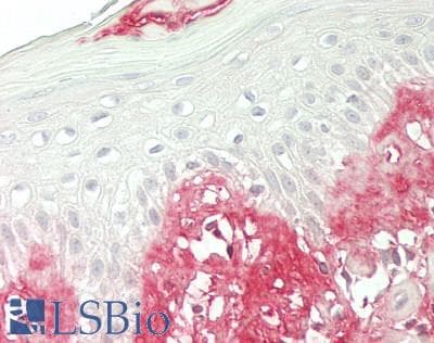 IHC-plus™ Polyclonal Rabbit anti-Human FGF1 / Acidic FGF Antibody (aa 16-155, IHC)