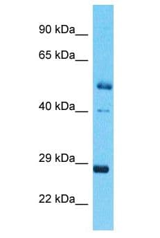 NRL Antibody (aa187-236)