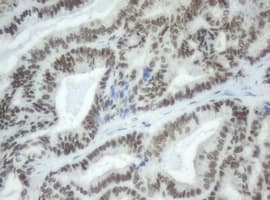 SF3A1 / SF3A120 Antibody (clone OTI4D8)
