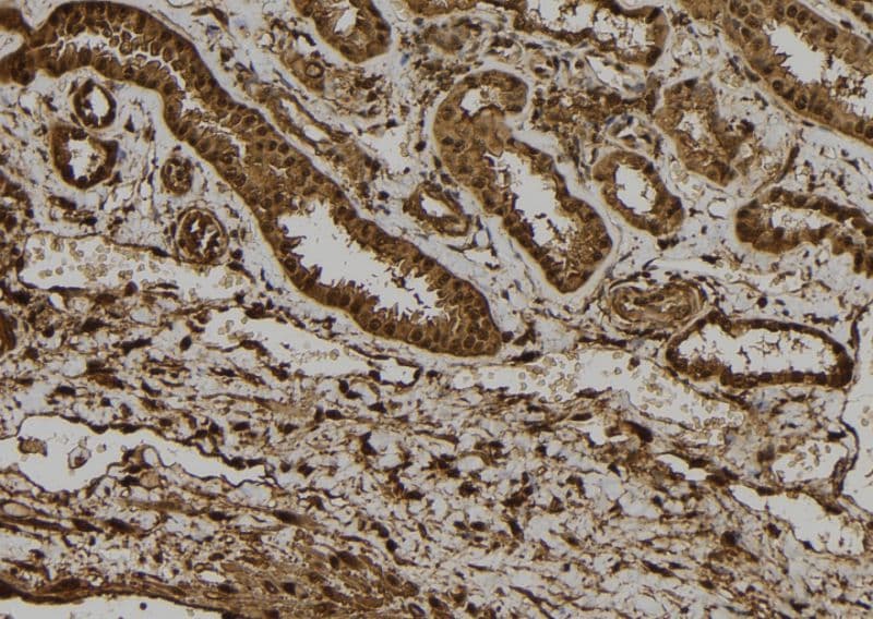 Polyclonal Rabbit anti-Human NRIP3 Antibody (IHC, IF, WB)
