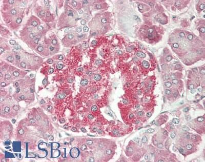 IHC-plus™ Myosin VI / MYO6 Antibody (N-Terminus)