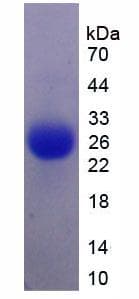 Pig IL6 / Interleukin 6 Protein (Recombinant His)