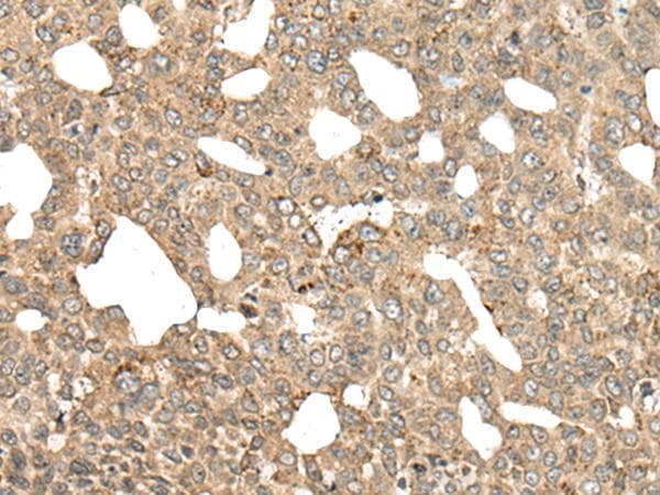Polyclonal Rabbit anti-Human APC Antibody (IHC)