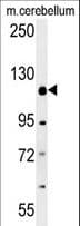 Radil Antibody (aa1044-1071)