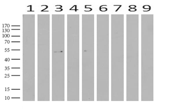 Monoclonal Mouse anti-Human ABAT Antibody (clone UMAB178, aa29-323, IHC, IF, WB)