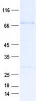 Human CLPB Protein (Recombinant His, N-Terminal)