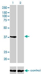 ANXA2 / Annexin A2 Antibody (clone 3E8-B6)