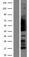 RPS5 / Ribosomal Protein S5 (Over-Expression Lysate Myc-DDK (Flag))