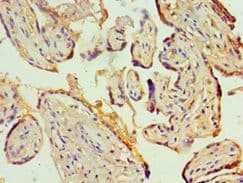 KCNN4 / KCa3.1 Antibody (aa288-427)