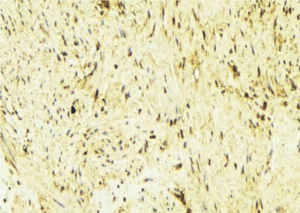 TPM1 / Tropomyosin Antibody
