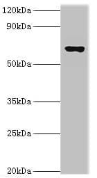 Polyclonal Rabbit anti-Human GAD1 / GAD67 Antibody (aa1-200, IHC, WB)