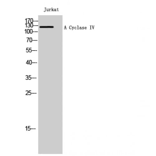 ADCY4 / Adenylate Cyclase 4 Antibody (170-250 aa, Internal)