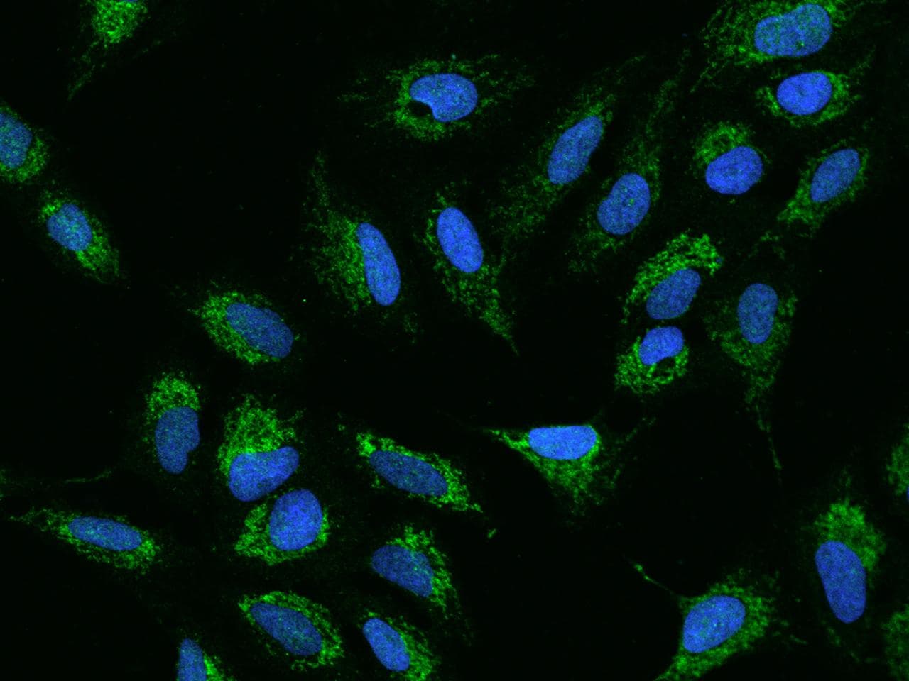 Polyclonal Rabbit anti-Human ADCK4 Antibody (IHC, IF)