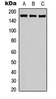 PathPlus™ EMA / MUC1 Antibody (Internal)