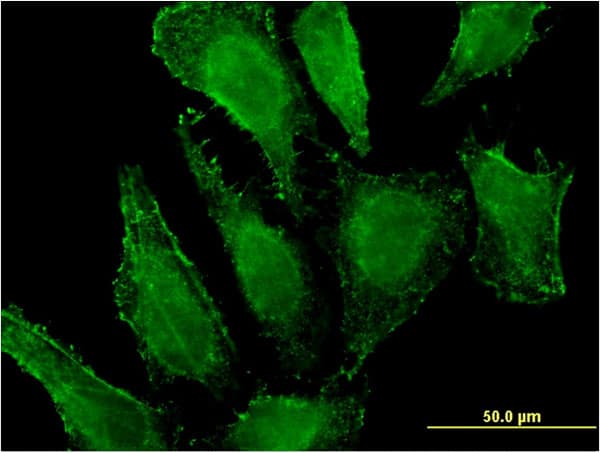 Monoclonal Mouse anti-Human MGST3 Antibody (clone 1C4, IF)