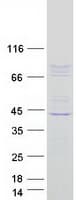 Human CSRP2BP Protein (Recombinant Myc-DDK (Flag))