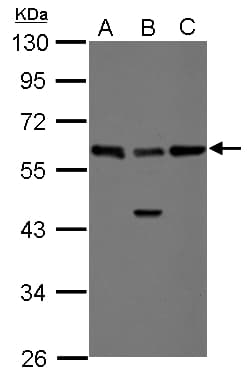 Polyclonal Rabbit anti-Human RAD23B / HR23B Antibody (IHC, IF, WB)