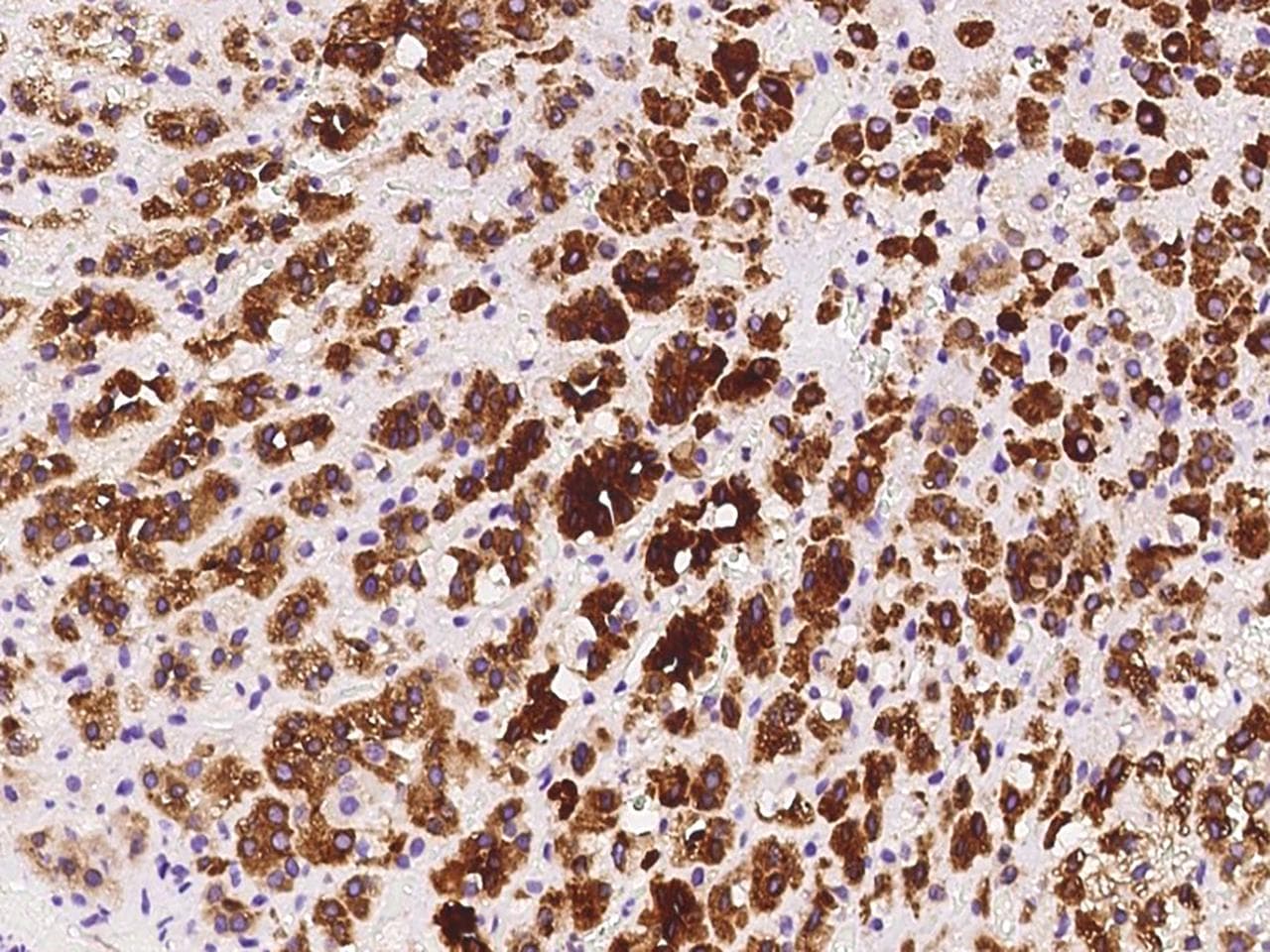 HELO1 / ELOVL5 Antibody