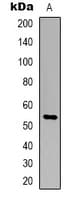 Polyclonal Rabbit anti-Human TIGD3 Antibody (C-Terminus, IHC, WB)