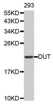 Polyclonal Rabbit anti-Human DUT / DUTPase Antibody (IHC, WB)