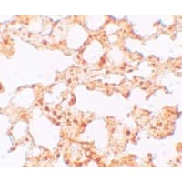 SLC39A6 / LIV-1 Antibody