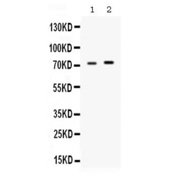 STI1 / STIP1 Antibody (aa505-543)