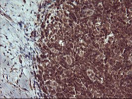 Placental Lactogen Antibody (clone OTI2G4)