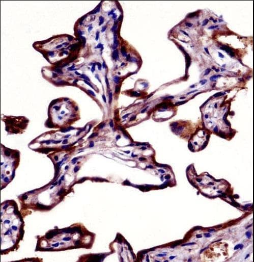 Polyclonal Rabbit anti-Human PLAP / Alkaline Phosphatase Antibody (aa56-83, IHC, WB)