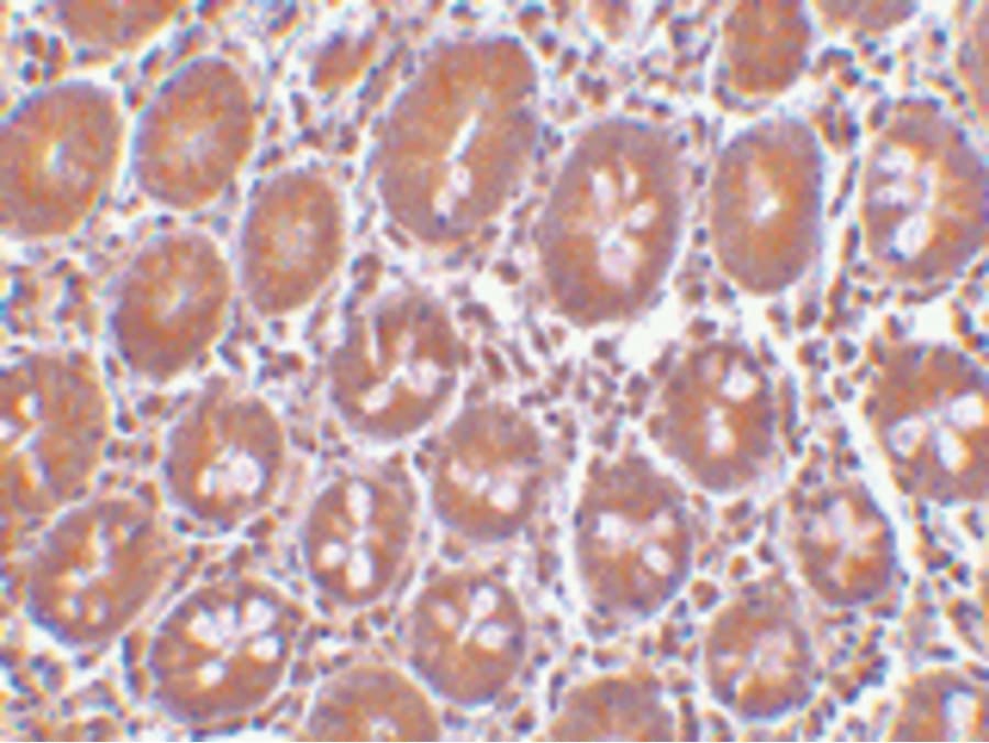 PTRH2 / BIT1 Antibody