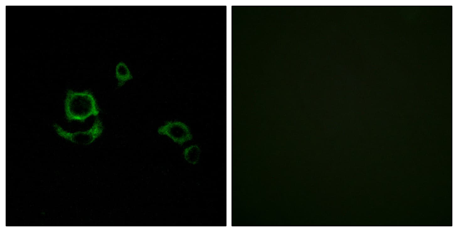 F13B / TGase Antibody (aa61-110)