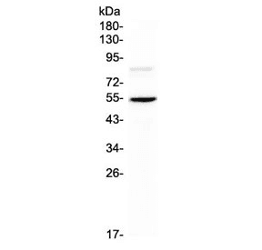 ANGPTL3 Antibody