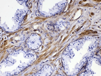 FLT4 / VEGFR3 Antibody