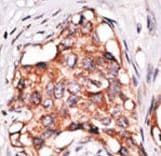 GDF3 Antibody (aa21-52)