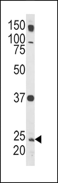 PathPlus™ Polyclonal Rabbit anti-Human RAB5A / RAB5 Antibody (aa182-211, IHC, IF, WB)
