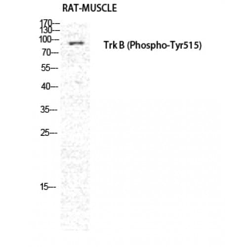 NTRK2 / TRKB Antibody (450-530 aa)