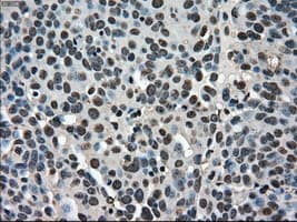 Monoclonal Mouse anti-Human STK39 / SPAK Antibody (clone OTI2E10, IHC, WB)