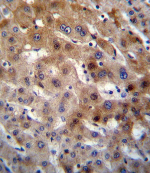 UGT2B15 Antibody (aa156-185)
