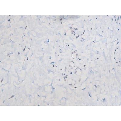 STAT1 Antibody (phospho-Ser727)