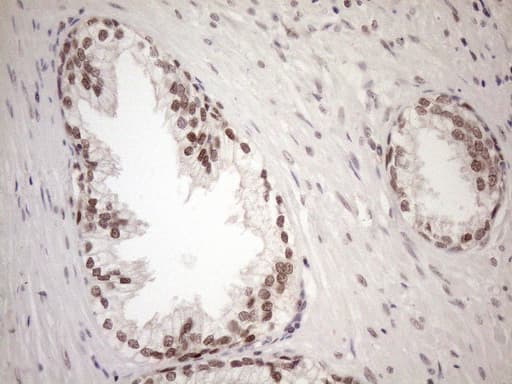 MGMT Antibody (clone OTI5A7)