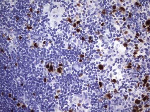 Monoclonal Mouse anti-Human TOP2A / Topoisomerase II Alpha Antibody (clone UMAB146, Carrier-free, aa1100-1531, IHC, WB)