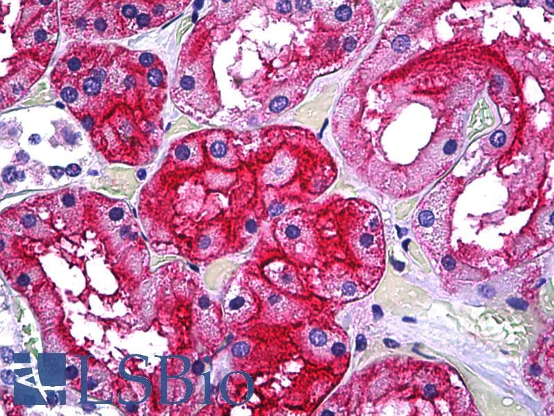 IHC-plus™ Monoclonal Mouse anti-Human GGT1 / GGT Antibody (clone 1F9, IHC, WB)