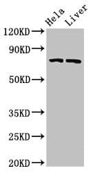 ACS5 / ACSL5 Antibody