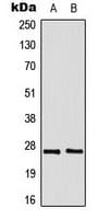 DDIT3 / CHOP Antibody (N-Terminus)