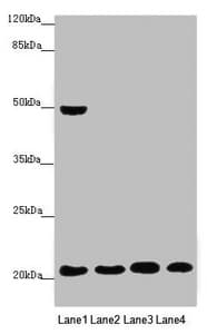 Polyclonal Rabbit anti-Human MOCS2 Antibody (IHC, IF, WB)