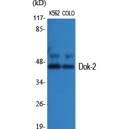 DOK2 Antibody (240-320 aa)