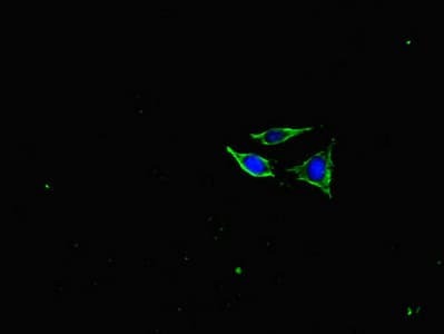 NF-L / NEFL Antibody (aa128-271)