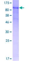 Human FBLN1 / Fibulin 1 Protein (Recombinant GST)