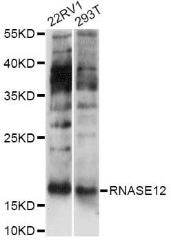 Polyclonal Rabbit anti-Human RNASE12 Antibody (WB)