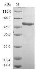 Human VENTX Protein (Recombinant GST, N-terminus)